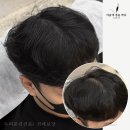 마음에점을찍다두피SMP 이미지