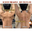 헬스케어재활센터 | 어깨 통증 주사가 안듣는 이유 [부산 해운대 헬스케어재활센터 임상 사례]