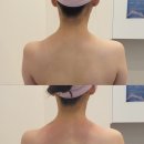 씨유 야탑아델파크점 | 분당 야탑피부관리 목어깨 관리 후기 - 올가드림뷰티 야탑아델파크점