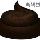 대변 색깔이 까만 흑색변 원인 이미지