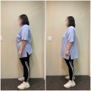 리도206호선 | 달서구 재활 운동 ] 이현기피티전문센터 디스크부터 측만증까지