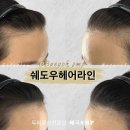 헤어라인