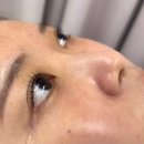 토탈아쿠아솔루션 | [부평] 엘리나팡 | 부평피부관리 아쿠아필패키지로 복합성 블랙헤드관리 해결하고 온 후기