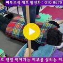 피부암(癌)으로 점점 썩어가는 피부를 살리는 특수 치료법 이미지