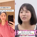 연예인 | 올타이트리프팅 후기 연예인들도 받는 이유는