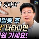 스케일링 안 아프게 받는 법.집에서 셀프 스케일링 해도 될까? 셀프 치석제거기 잘못 사용하면 큰일납니다. 이미지