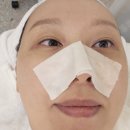 예스메디(YES MEDI) | 서면에스테틱 리안메디센터 다이아몬드필 GD토닝 플라즈마 일대일맞춤관리