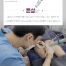 훈의원 | 허벅지 엉덩이튼살 튼살레이저 가격 부담 없는 곳에서