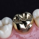 골드크라운 이미지