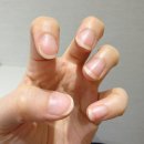 용산-311 | 비타민D 주사 후기 | 가격 실비 효과까지 직접 맞아보고 정리 (용산 더우아의원)