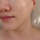윤아 | 동래 안락동피부관리 윤아에스테틱 수부지 피부고민 스킨부스터 후기