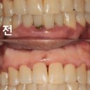 메디포레치과의원 이미지