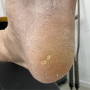 세븐일레븐 화성봉담주공점 | 화성 봉담 기안동 발각질 제거 깨끗하게 잘하는 발라발라네일 봉담점