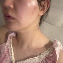 수기자연체형관리(주간) | 병점 체형교정 근막이완 수기관리 여드름 문제성피부 순환 아이앤비뷰티랩 중간후기
