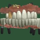 뉴치과기공소 이미지