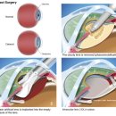 한사랑안과 이미지