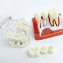 본치과기공소 이미지