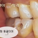 지니세라믹 이미지