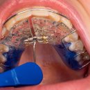 안면본치과의원 이미지