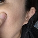 Bella | WHITE BELLA 기미패치 사용후기