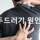 두드러기 원인, 피부 가려움증 이외의 주의 증상은? 이미지