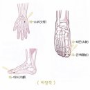 월오사암침 만성 염증 치료 이미지