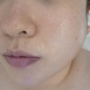 온날 | 별내에스테틱 온날뷰티에서 받은 별내동 피부관리 후기