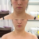 세븐일레븐 의정부가능5호점 | 의정부 윤곽관리 신부관리 이중턱 리프팅 유얼핏 에스테틱