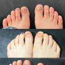 살롱드 멍 | 대구 문제성발톱관리 | 살롱드더싹 | 대봉동멍든발톱관리 | 전후사진비교 후기