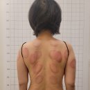 동래피트니스 | 부산바디관리 동래 스페이스뷰티 AI측청 피트니스돔, 등관리 후기