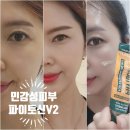 파이토신 V2로 바꾸고 피부 인생 달라졌어요! 피부 트러블 끝판왕(6월 최저가 찬스)