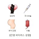 만성 C형 간염(Chronic hepatitis C) 이미지