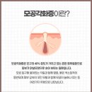 닭살이야 이미지