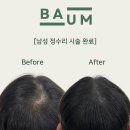 바움SMP