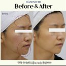 순수스킨케어 이미지