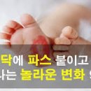 파스 이미지