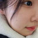 그레이스셀강남병원 | 강남 줄기세포주사 후기ㅣ오앤셀 후기