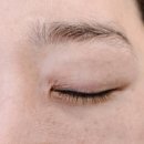 더예쁜eye 이미지