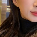 민가한의원 | 내돈내산 청주 피브로 한의원 돌출점 제거