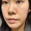 올영세일 추천템 화잘먹 웰라쥬 히알루론산 앰플+크림 후기