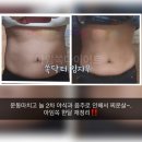 럭키케어