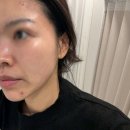 순천연향초등학교 | 순천 피부샵 추천 연향동 스킨오브유 첫방문 이벤트