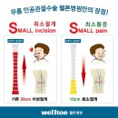 무릎인공관절수술 후 회복기간이 궁금하시다면 들어오세요~잘몰랐던 사실에 대해 알려드리겠습니다!!!! 이미지