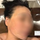 비봉로R | 진주에스테틱 뷰티앤힐링 부모님께 싸이블로 리프팅 관리 선물로 효도한 후기