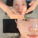 평택 윤곽관리 소사벌 폴링뷰티 얼굴경락 피부관리 전후!