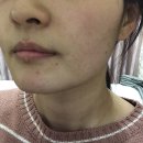 용현동 토탈샵 추천 : 쉬즈뷰티 피부관리 보노필링...여드름 압출 왁싱 속눈썹펌 속눈썹연장 솔직 후기