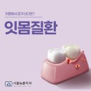 서울뉴본치과의원 | 장안동치과 잇몸치료 언제 필요할까요