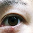 부평열린안과의원 이미지