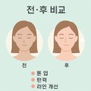 다엘안 | [부산 다엘에스테틱 후기] 등관리 + 작은얼굴 윤곽관리 받고 확실히 달라진 피부와 라인!