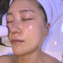 [분당 피부관리실 후기] 미금역 보떼마망 지루건성 여드름 모공케어